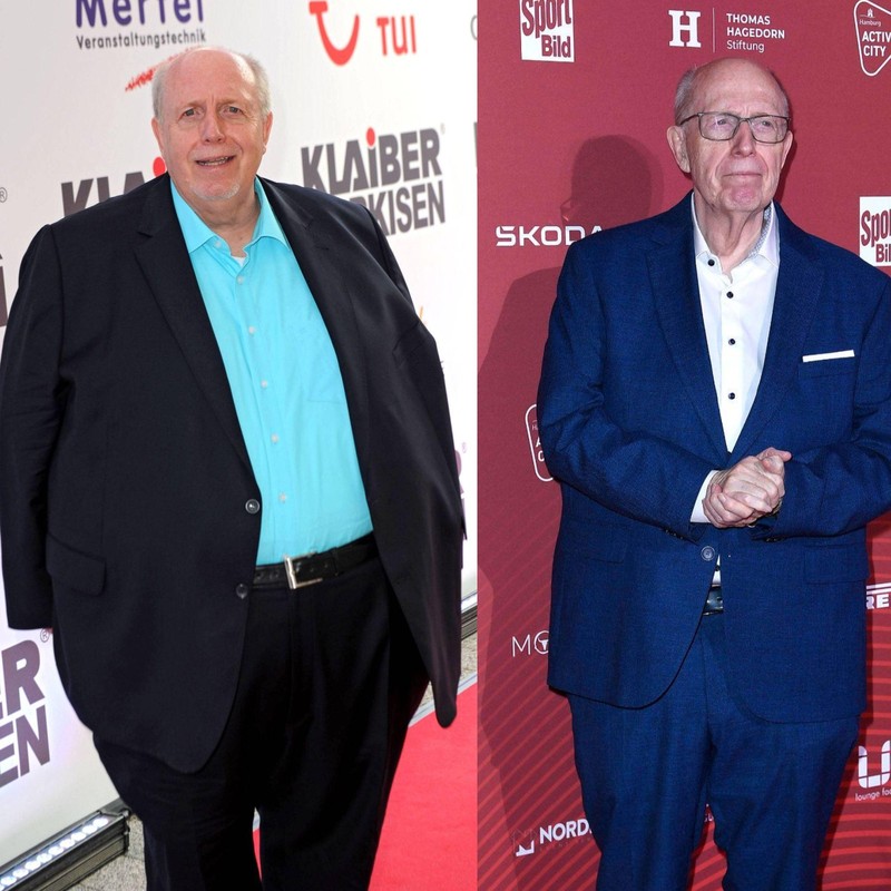 In den vergangenen Jahren hat Reiner Calmund viel Gewicht verloren und unterzog sich sogar einer Operation.