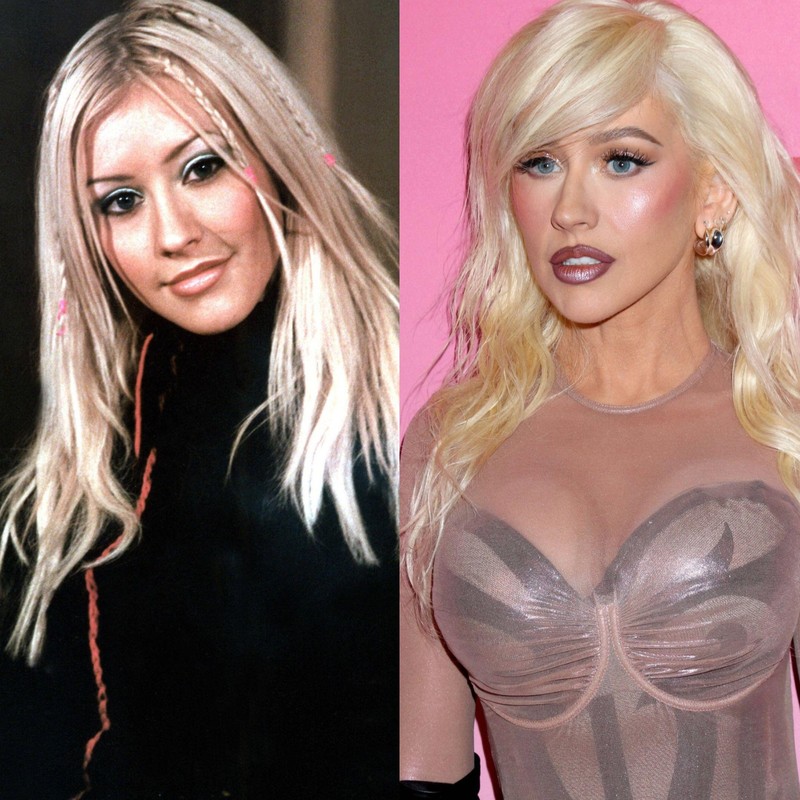 Christina Aguilera gab 2023 zu, zu Botox gegriffen zu haben. Gibt es noch weitere Eingriffe?