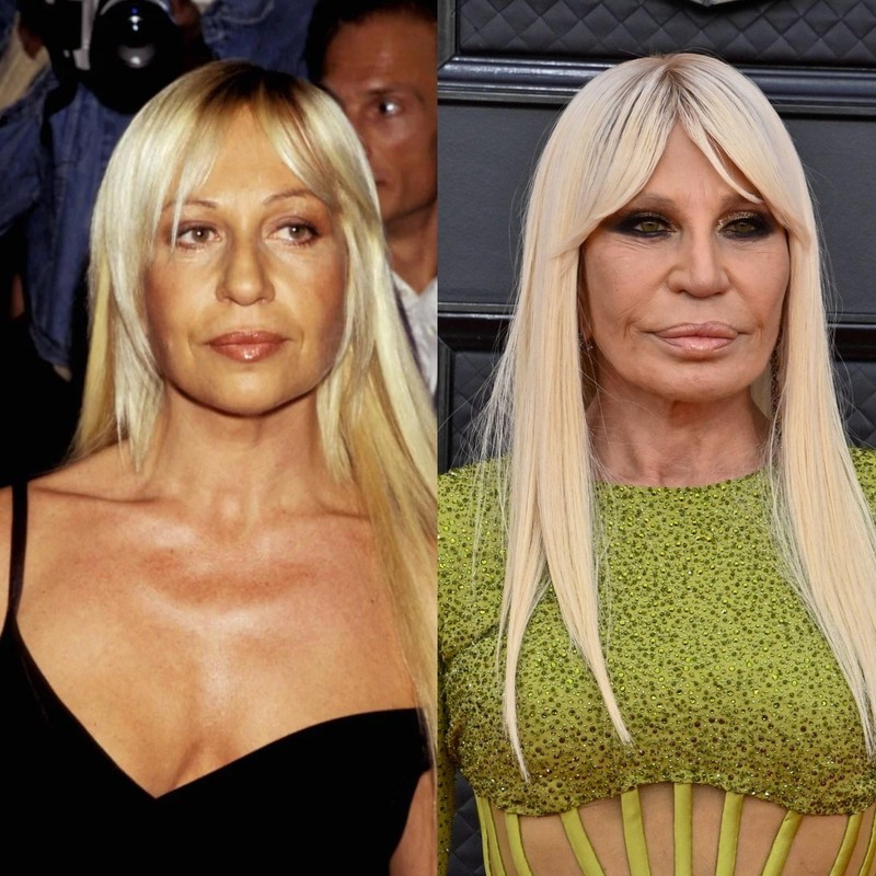 Donatella Versace erregte mit einer ganz neuen Optik im Jahr 2024 die Aufmerksamkeit der Öffentlichkeit