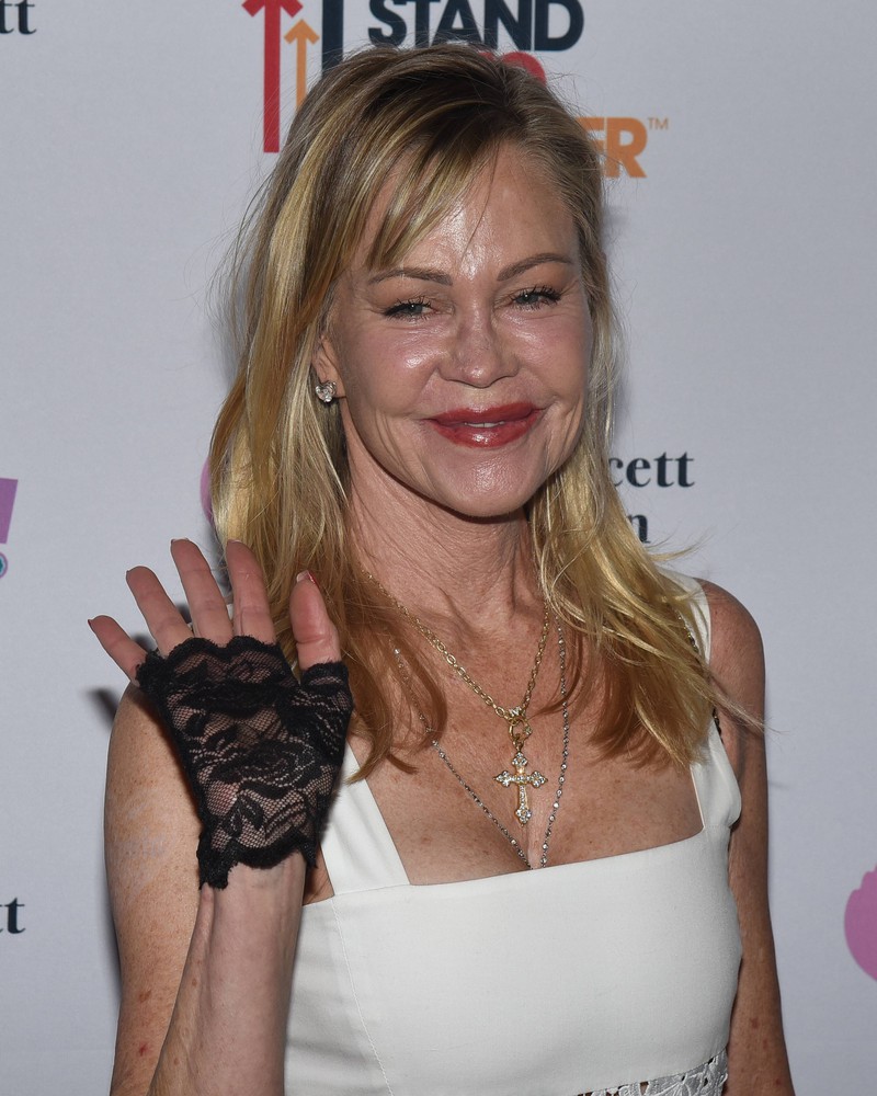 Heute ist Melanie Griffith kaum wiederzu erkennen