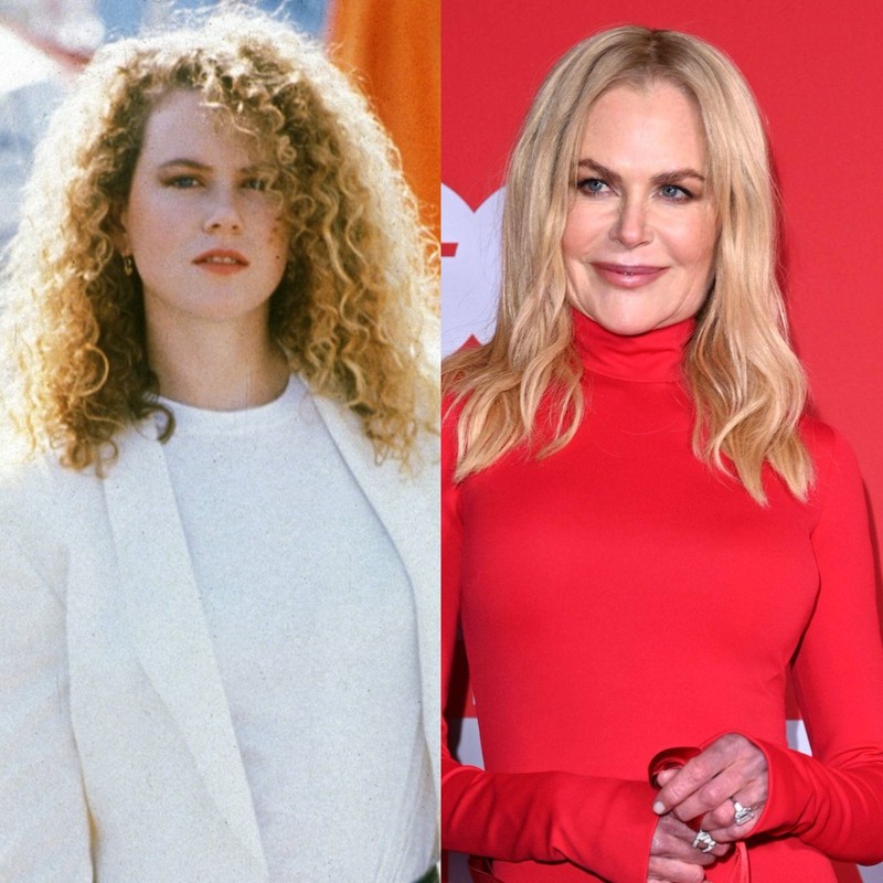 Nicole Kidman hat sich augenscheinlich schon mehrere Male unters Messer gelegt. Sie leugnet es allerdings