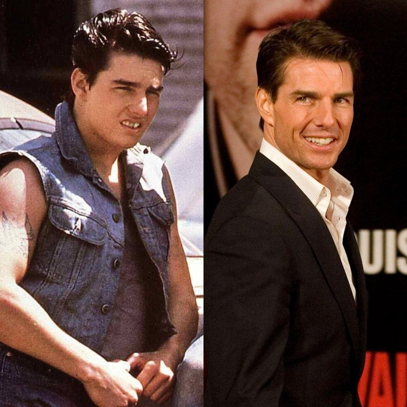 Damals hatte Tom Cruise noch keine Zahnkorrektur, wenn man genauer hinschaut.