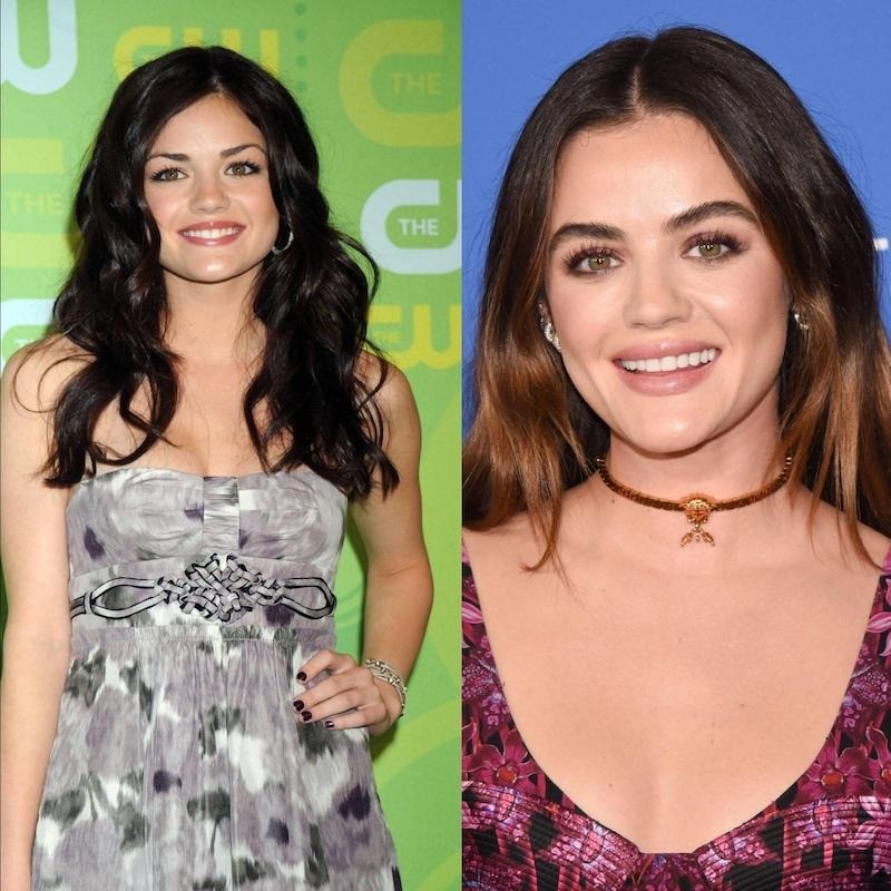 Auch heute noch ist Lucy Hale als Schauspielerin unterwegs, mit „Pretty Little Liars“ feierte sie jedoch ihren Durchbruch.