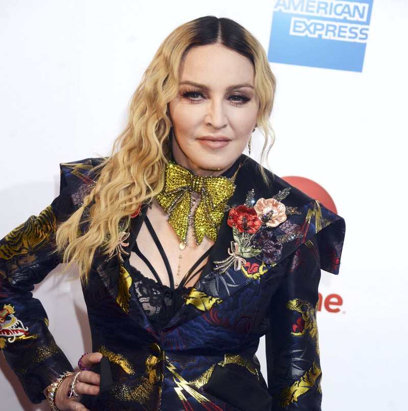 Madonna ließ sich scheinbar oftmals vom Schönheitschirurg operieren.