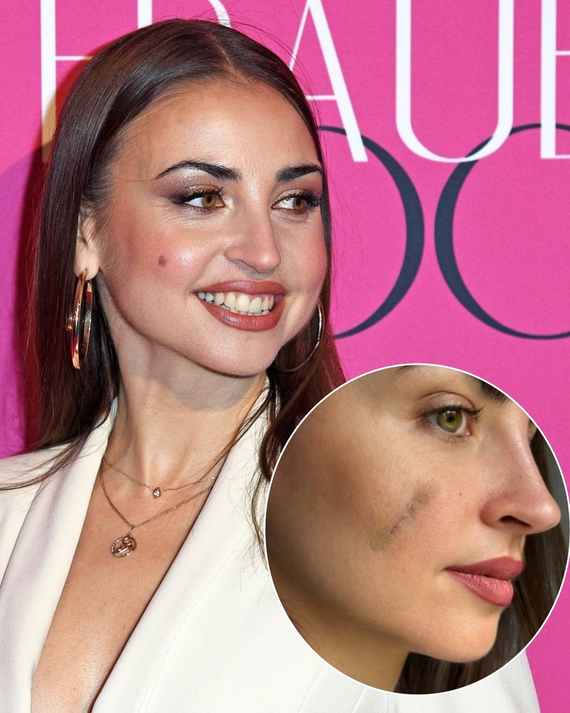 Die Ergebnisse von Ekaterinas Laboruntersuchungen bezüglich ihres entfernten Muttermals sind da.