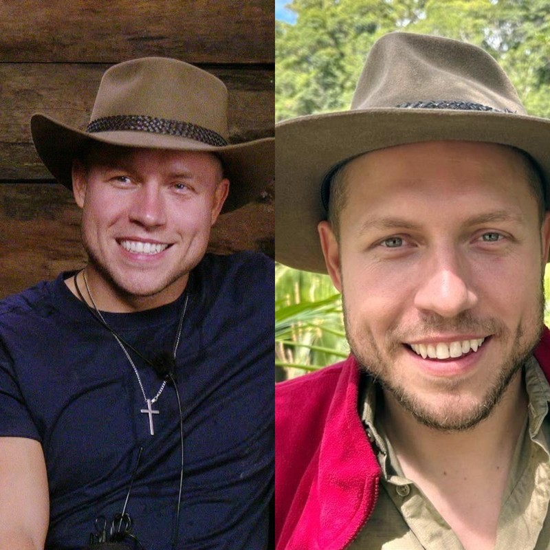 Patrick Romer verlor sieben Kilo im Dschungelcamp.